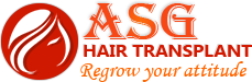 ASG Hair Transplant